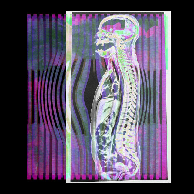 Live Burn 7: Live to Burn album cover