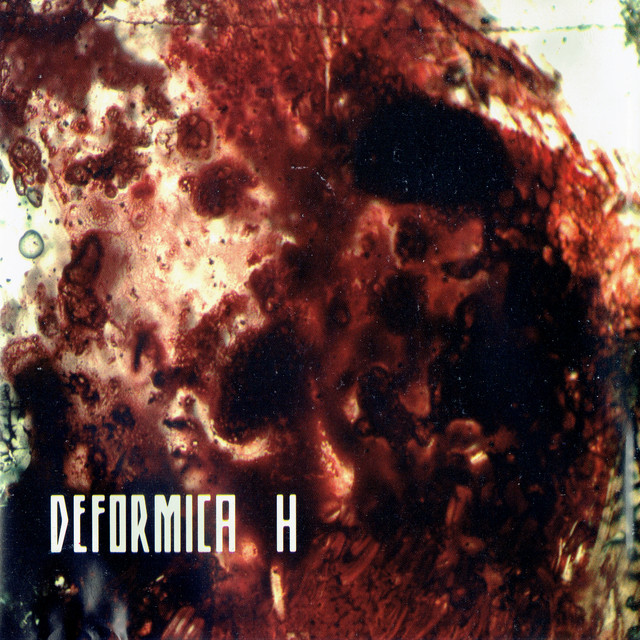 H album cover