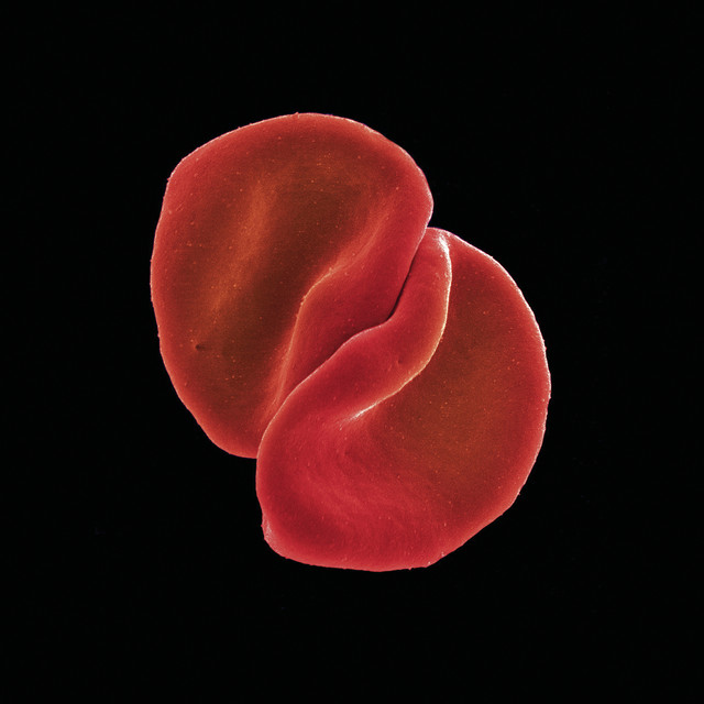 Brauner VMA as heard on Scratch My Back (Special Edition) by Peter Gabriel (2010)