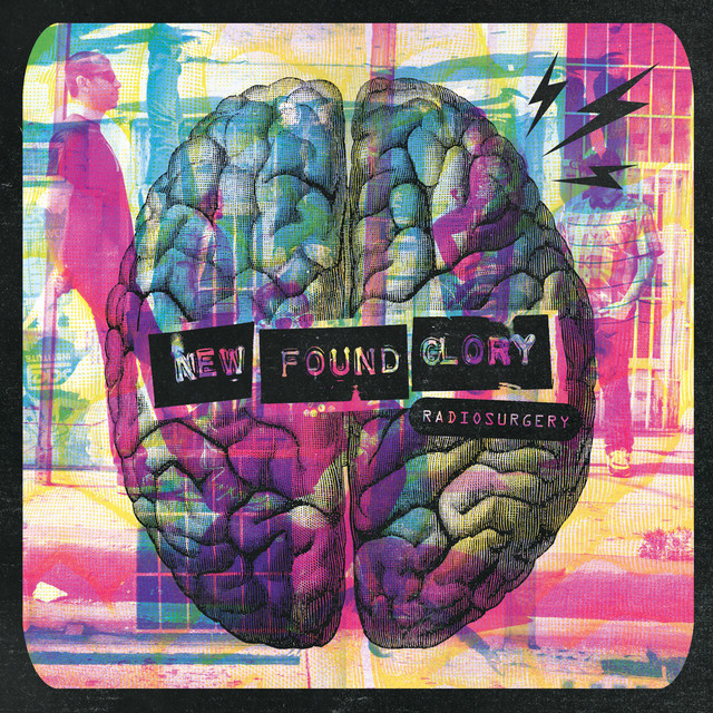 Radiosurgery (Deluxe Edition) album cover