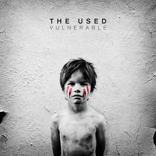 Vulnerable album cover