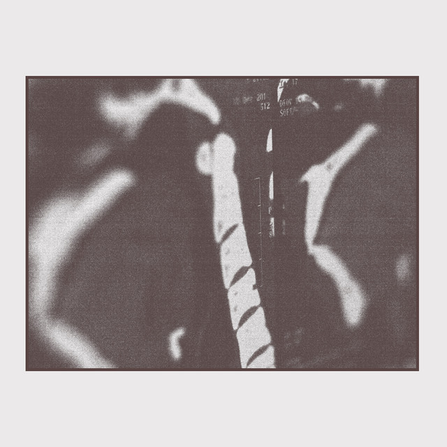 MRI album cover