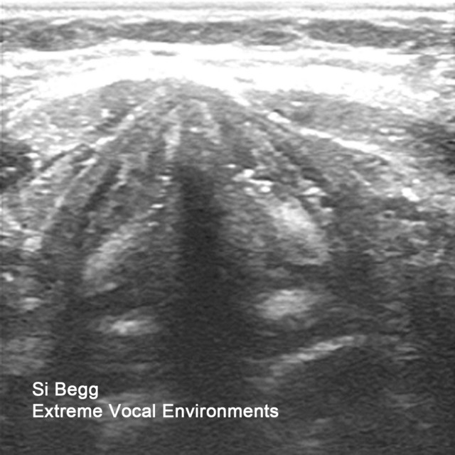 Extreme Vocal Environments album cover