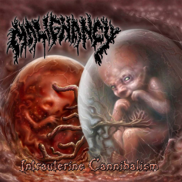 Intrauterine Cannibalism album cover