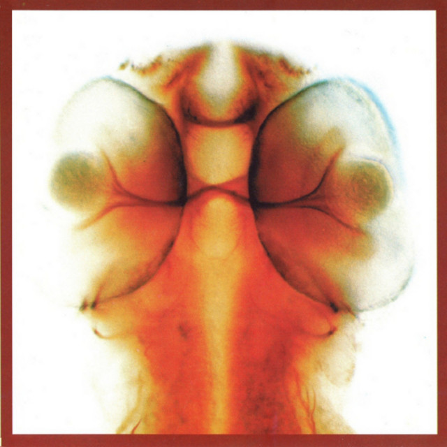 Damage album cover