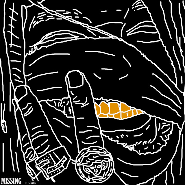 Missing Molars (SWNT Deluxe) album cover