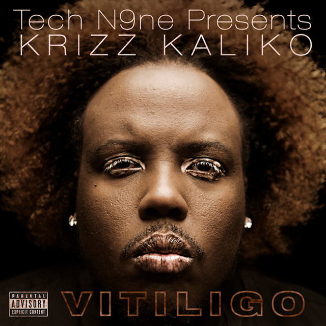 Vitiligo album cover