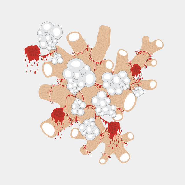 The Exquisite Death of Saxon Shore album cover