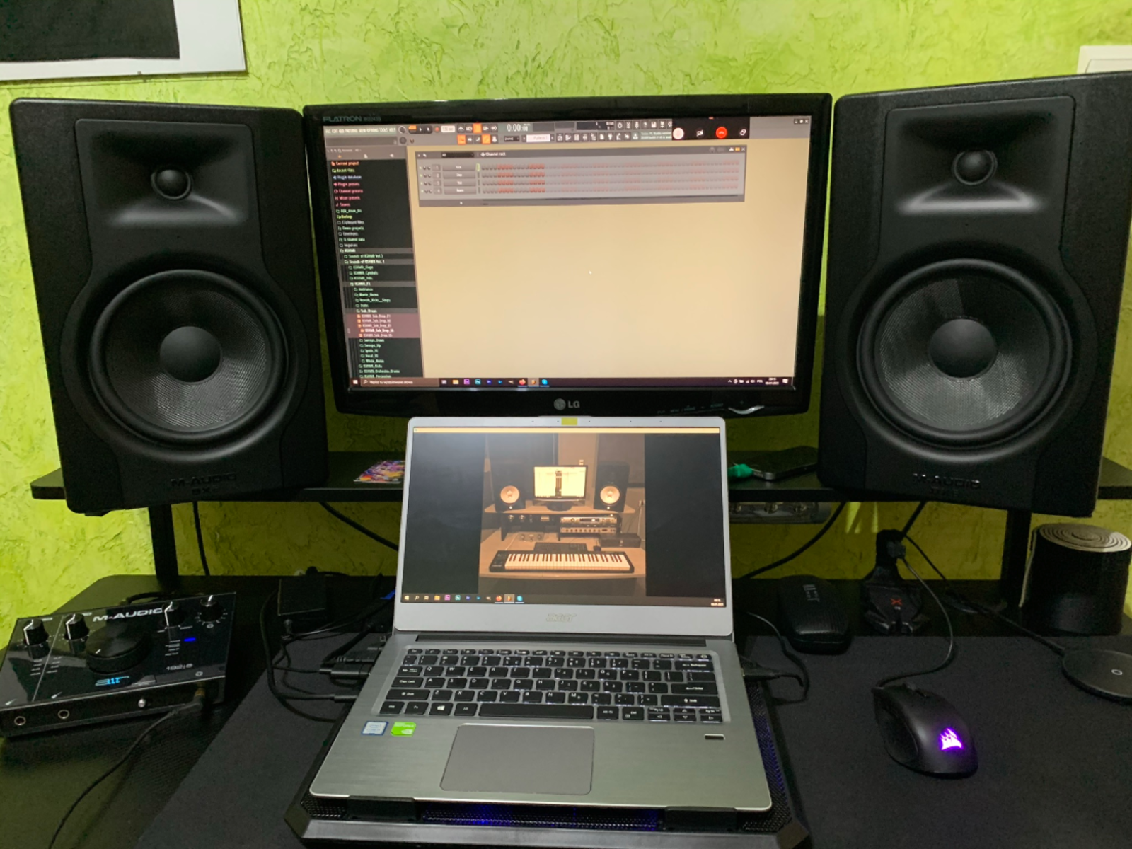 mvp's music gear photo