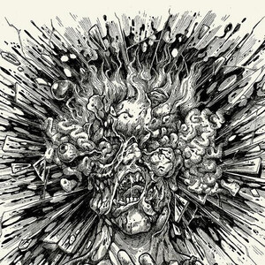 Severe Torture