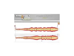 Celemony Melodyne Editor